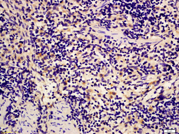 IGFBP4 Rabbit Polyclonal Antibody