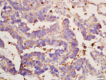 IL12B Rabbit Polyclonal Antibody