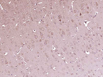 Phospho-IKK alpha (Ser176) Rabbit Polyclonal Antibody