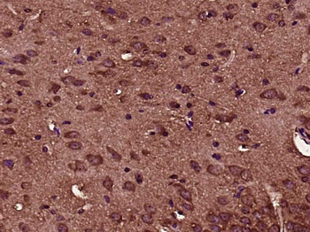 Phospho-IKB alpha (Ser32) Rabbit Polyclonal Antibody