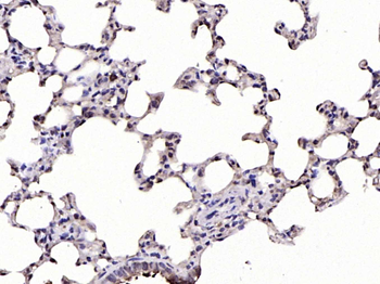Phospho-IKB alpha (Ser32) Rabbit Polyclonal Antibody