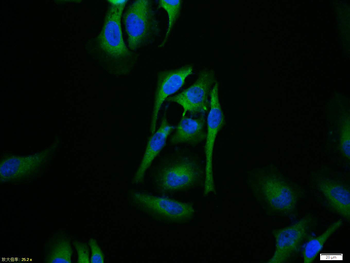 Phospho-IKB alpha (Ser32) Rabbit Polyclonal Antibody