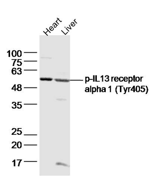 Phospho-IL13RA1 (Tyr405) Rabbit Polyclonal Antibody