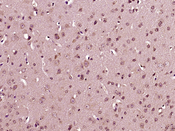 IL23 P19 Rabbit Polyclonal Antibody