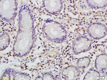 I-309/CCL1 Rabbit Polyclonal Antibody