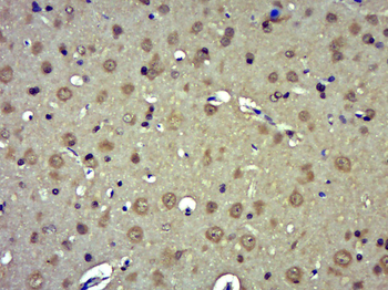 Phospho-IP3 receptor (Ser1598) Rabbit Polyclonal Antibody