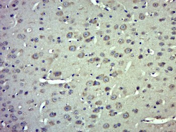 IP6K1 Rabbit Polyclonal Antibody