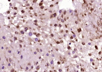 JNK1+JNK2 Rabbit Polyclonal Antibody
