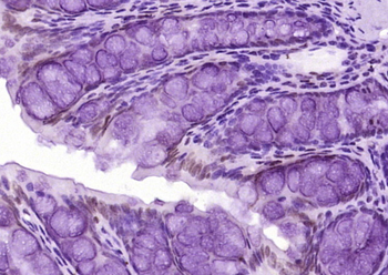 JNK1+JNK2 Rabbit Polyclonal Antibody