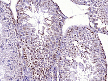 JAZF1 Rabbit Polyclonal Antibody