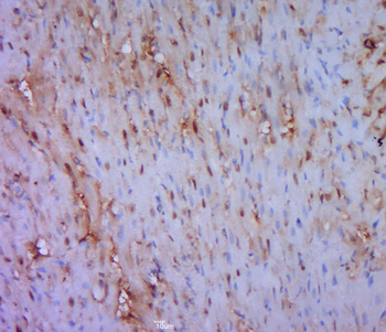 Phospho-JNK1 (Thr183) Rabbit Polyclonal Antibody