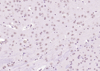 KEAP1 Rabbit Polyclonal Antibody