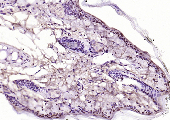 KEAP1 Rabbit Polyclonal Antibody