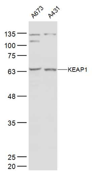 KEAP1 Rabbit Polyclonal Antibody