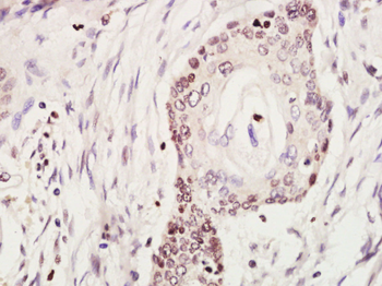 KEAP1 Rabbit Polyclonal Antibody