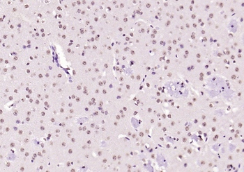 KEAP1 Rabbit Polyclonal Antibody