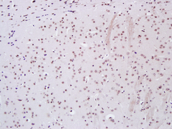 KEAP1 Rabbit Polyclonal Antibody