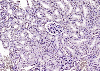 KEAP1 Rabbit Polyclonal Antibody