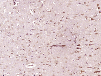 Phospho-GluR1 (Ser849) Rabbit Polyclonal Antibody