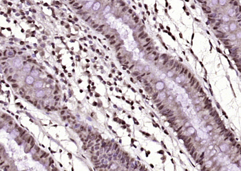 KLF12 Rabbit Polyclonal Antibody