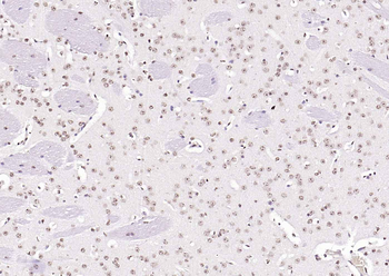 KLF12 Rabbit Polyclonal Antibody