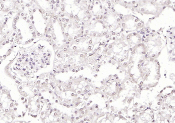 KLF12 Rabbit Polyclonal Antibody