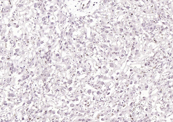 KLF12 Rabbit Polyclonal Antibody