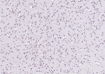 KLF12 Rabbit Polyclonal Antibody