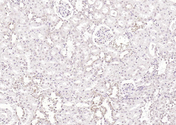 KLF12 Rabbit Polyclonal Antibody