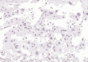 KLF12 Rabbit Polyclonal Antibody