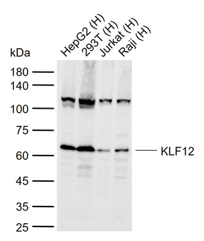 KLF12 Rabbit Polyclonal Antibody