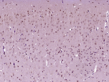 KMT2D/ALL1 Rabbit Polyclonal Antibody