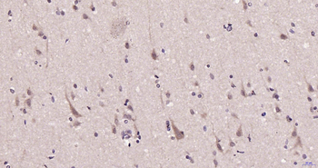 KMT3C Rabbit Polyclonal Antibody