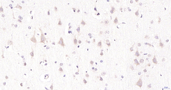 KMT3C Rabbit Polyclonal Antibody