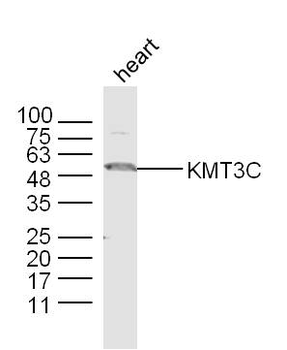 KMT3C Rabbit Polyclonal Antibody