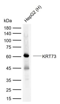KRT73 Rabbit Polyclonal Antibody