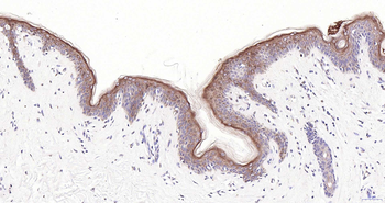 KRT83 Rabbit Polyclonal Antibody