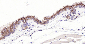 KRT83 Rabbit Polyclonal Antibody