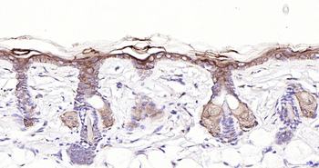 KRT83 Rabbit Polyclonal Antibody