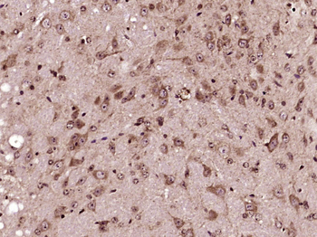 Kv1.2 Rabbit Polyclonal Antibody