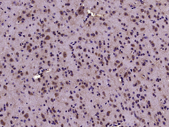 Kv1.2 Rabbit Polyclonal Antibody