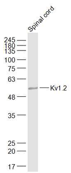 Kv1.2 Rabbit Polyclonal Antibody