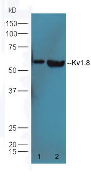 Kv1.8 Rabbit Polyclonal Antibody