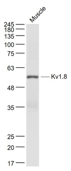 Kv1.8 Rabbit Polyclonal Antibody