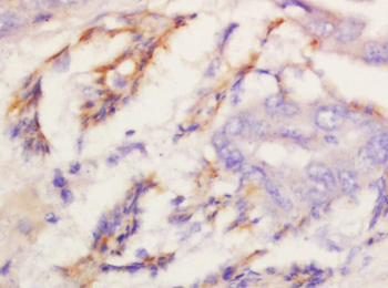 Kv1.8 Rabbit Polyclonal Antibody