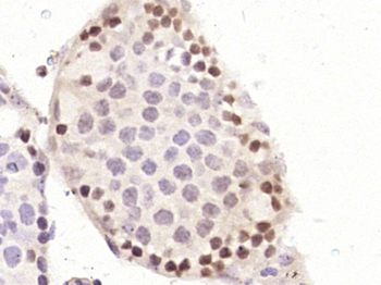 Phospho-Ku70 / XRCC6 (Ser5) Rabbit Polyclonal Antibody