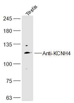 KCNH4 Rabbit Polyclonal Antibody