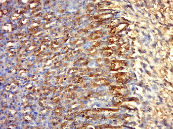 KCNH6 Rabbit Polyclonal Antibody
