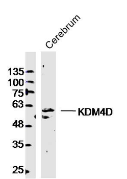 KDM4D Rabbit Polyclonal Antibody