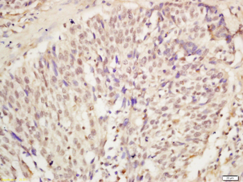 KDM5A Rabbit Polyclonal Antibody